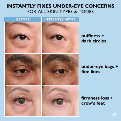ROSERUNE™ Instant Face Temporary Tightener – Instant visible results in 60 seconds